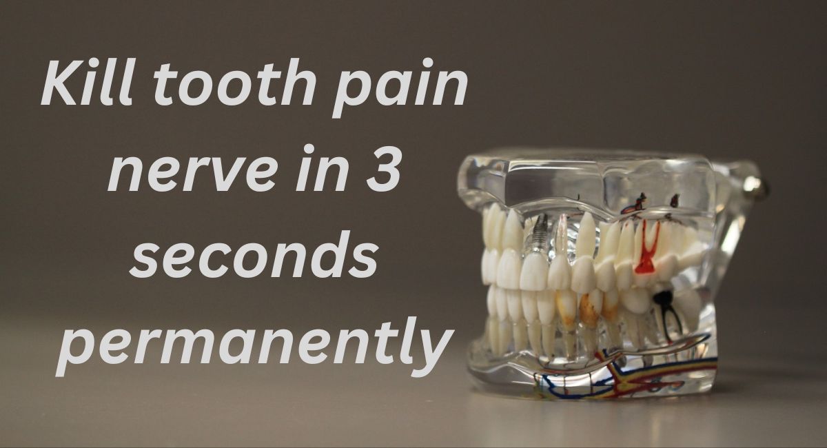 Kill Tooth Pain Nerve in 3 Seconds Permanently